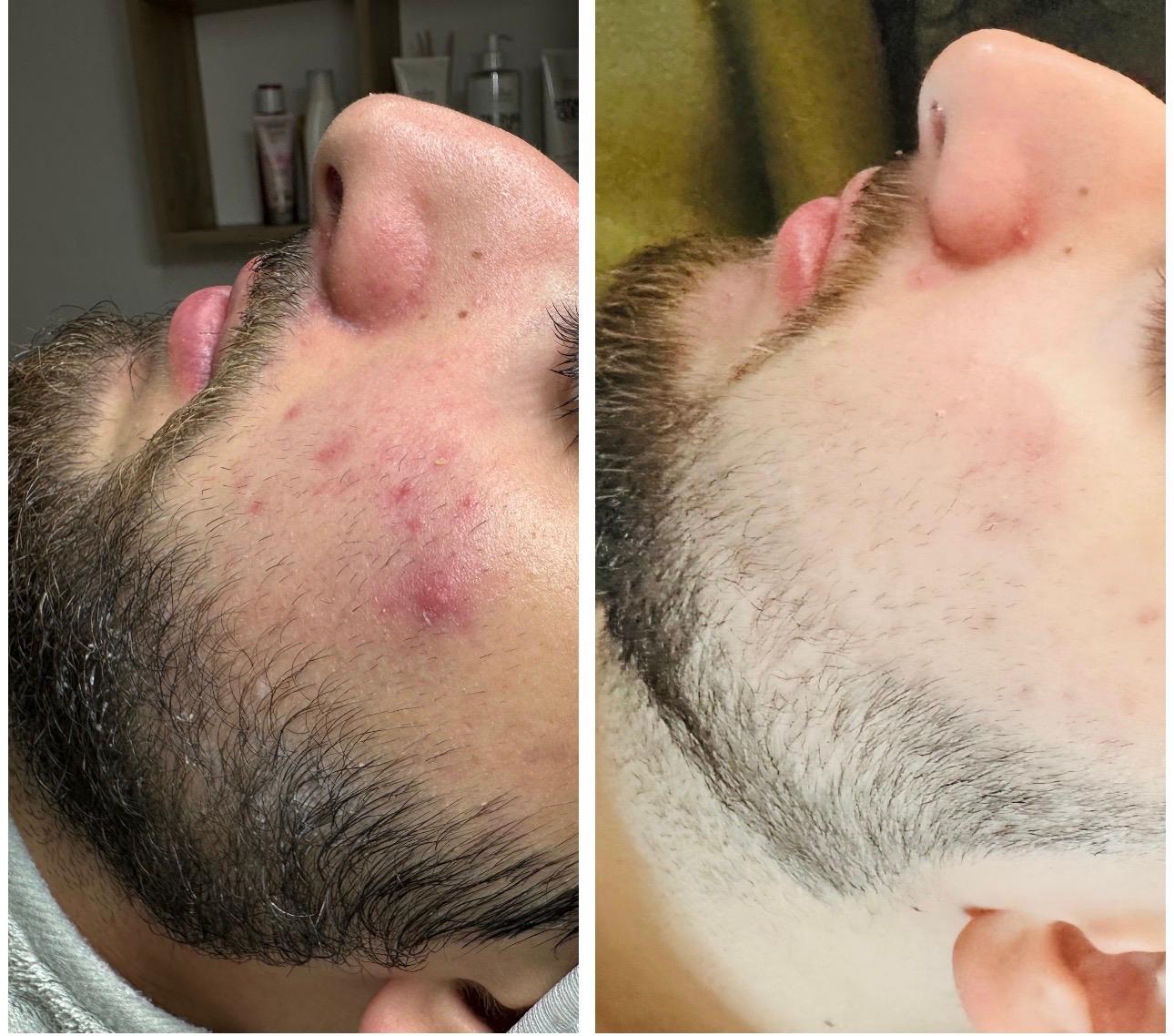 Aromatherapie und Entspannung im Kosmetikstudio